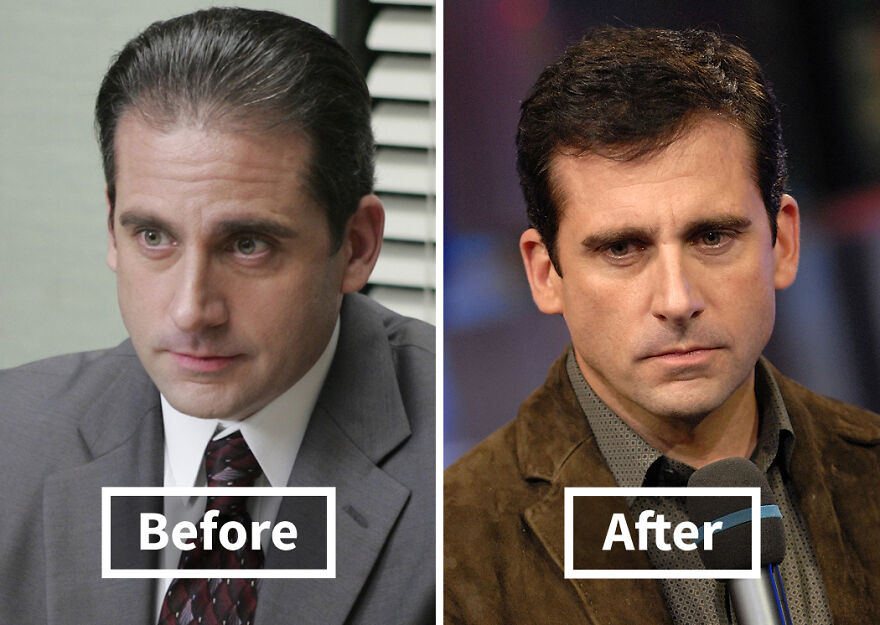 Side-by-side before and after photos of a Steve Carell showcasing results of hair transplants and hair restoration.