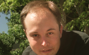 19 Celebrities Who Look Noticeably Better After Hair Transplants