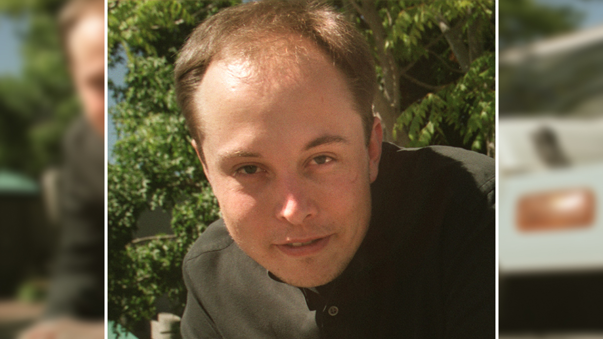 Man with thinning hair outdoors in natural light, illustrating hair transplant results of celebrities who look unrecognizable now.