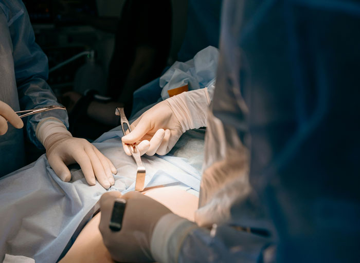 “Plastic Surgeons, What’s The Most Ridiculous Surgery You’ve Performed?”