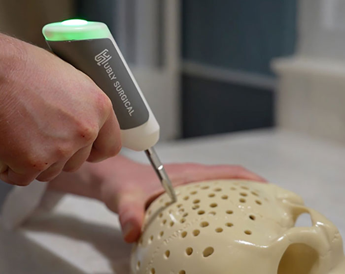 Hand holding a surgical drill device creating holes in a skull model related to brain surgeon arrest news. Hand holding a surgical drill device creating holes in a skull model related to brain surgeon arrest news.