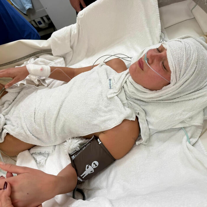 Bella Hadid resting with medical equipment, highlighting fans stunned by the weight of her Victoria’s Secret angel wings. Bella Hadid resting with medical equipment, highlighting fans stunned by the weight of her Victoria’s Secret angel wings.