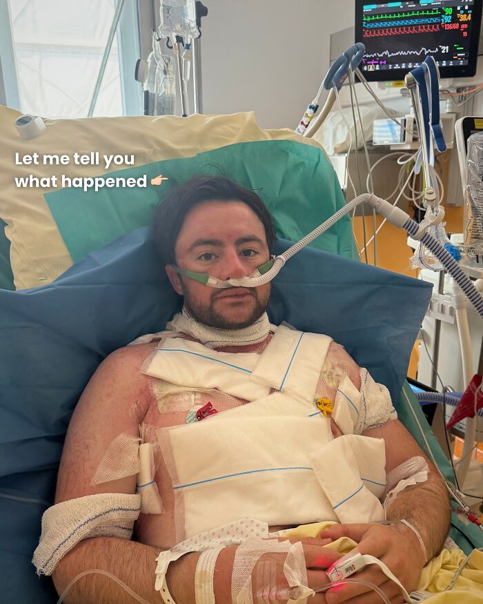 Man Who Swam For 110 Miles Without Sleeping Reveals "Intense" Hallucinatory Experience Man Who Swam For 110 Miles Without Sleeping Reveals "Intense" Hallucinatory Experience