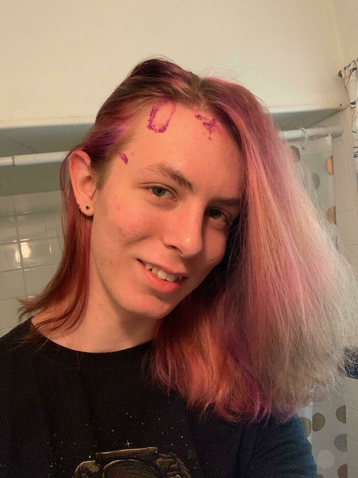 Person with unevenly dyed hair and purple dye stains on forehead, showing an example of hilariously tragic hair accidents.