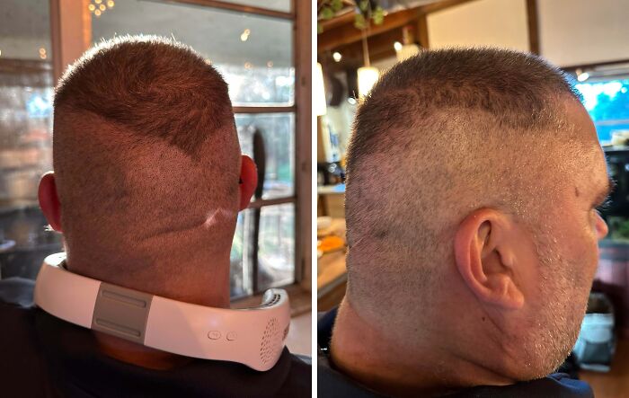 Man with a tragic hair accident showing uneven shaved patches on the back and side of his head indoors.