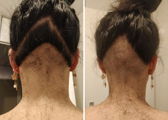 Undercut hair accident showing uneven, patchy shaving resulting in a hilariously tragic hair mishap from behind.