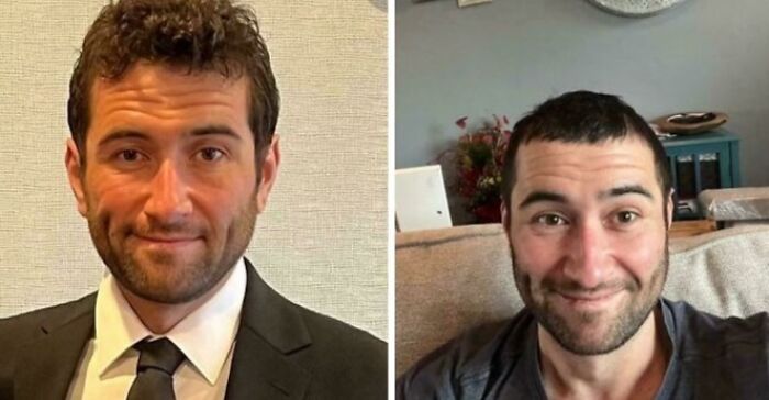 Before and after photos of a man showing a hilariously tragic hair accident transformation with a very short haircut.