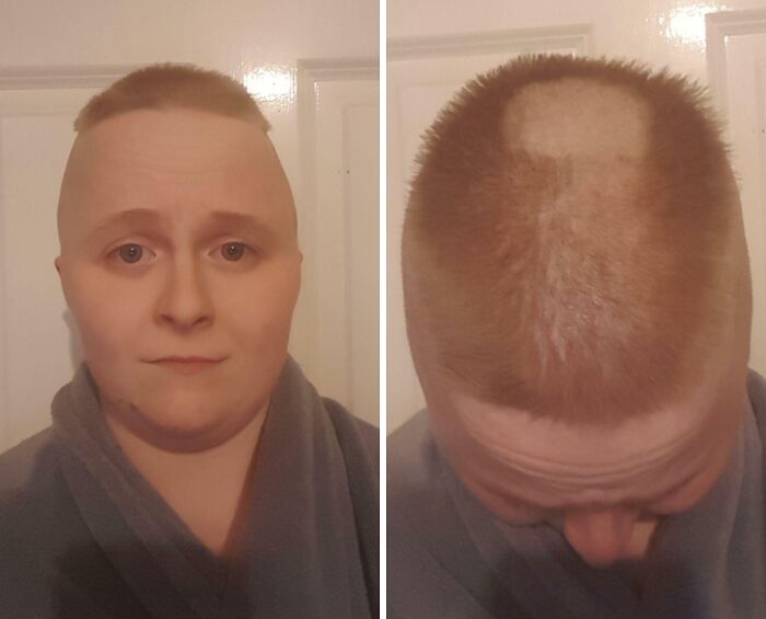 Person wearing a robe with a hilariously tragic hair accident showing an uneven patchy haircut from front and top views.