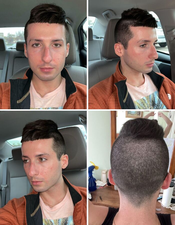 Young man with a hilariously tragic hair accident showing uneven, patchy haircut from multiple angles inside a car and room.