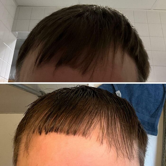 Two close-up photos showing hilariously tragic hair accidents with uneven and poorly cut bangs.