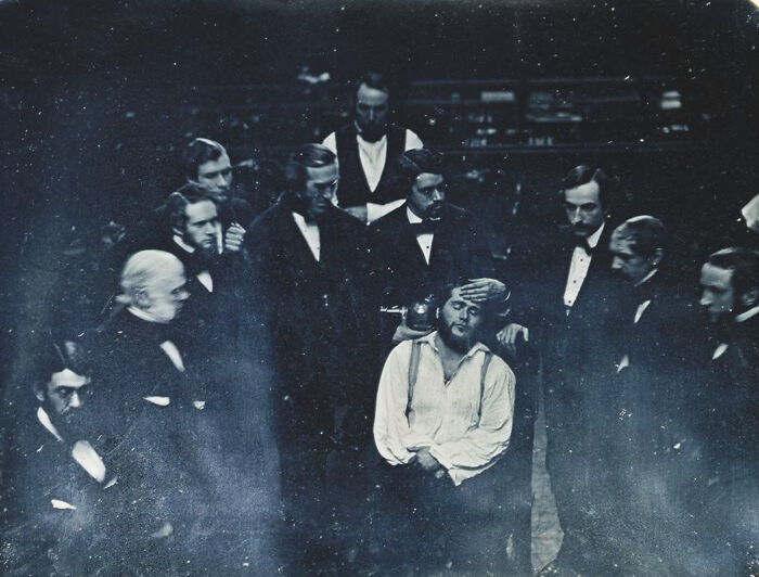 Early photography shows a group of men in formal attire observing a medical procedure on a seated patient.