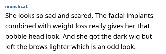 Ariana Grande with dramatic new look featuring facial implants, weight loss effects, and contrasting dark wig and lighter brows. Ariana Grande with dramatic new look featuring facial implants, weight loss effects, and contrasting dark wig and lighter brows.