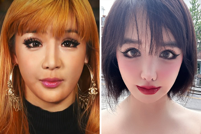 K-Pop icon Park Bom shown before and after her drastic plastic surgery transformation with notable makeup and hairstyle changes. K-Pop icon Park Bom shown before and after her drastic plastic surgery transformation with notable makeup and hairstyle changes.
