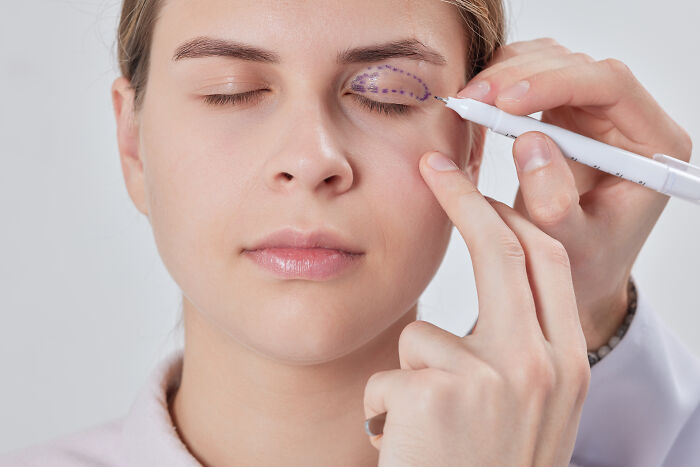 Woman with eyes closed having plastic surgery marks drawn around eyelid, highlighting plastic surgery speculation concept. Woman with eyes closed having plastic surgery marks drawn around eyelid, highlighting plastic surgery speculation concept.