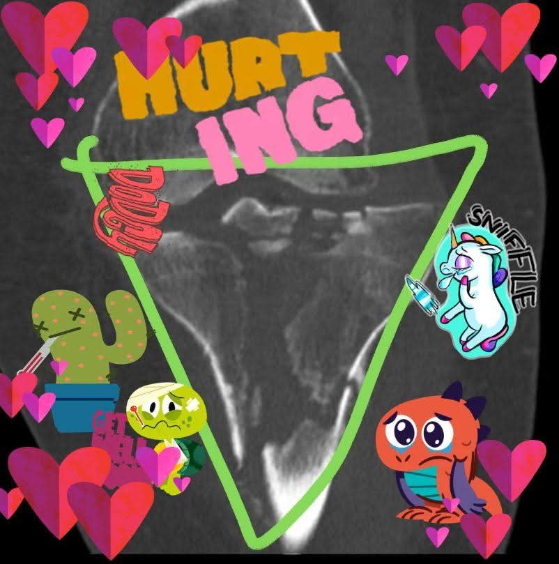 X-ray image with colorful cartoon stickers illustrating hurt and damage, emphasizing the concept of worst damage done to oneself.