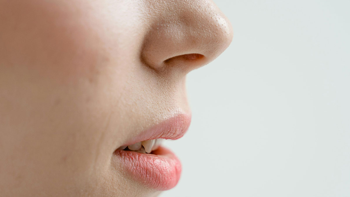 Close-up of a person's lips and nose showing natural skin texture, related to cosmetic procedure concerns.