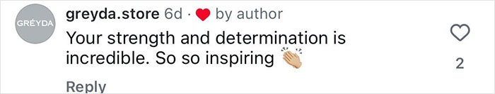 Comment praising strength and determination, describing the inspiring story of 20-year-old amputating leg after rock concert experience. Comment praising strength and determination, describing the inspiring story of 20-year-old amputating leg after rock concert experience.