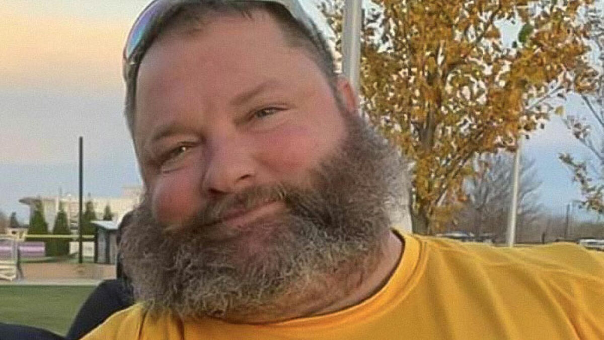 Bearded man outdoors in a yellow shirt with autumn trees in the background, related to morbidly obese patient and Instagram dentist.