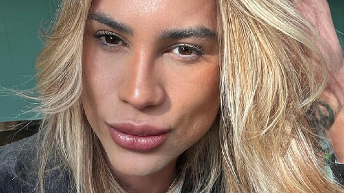 Close-up of influencer with blonde hair, highlighting features related to fox eyes surgery complications.