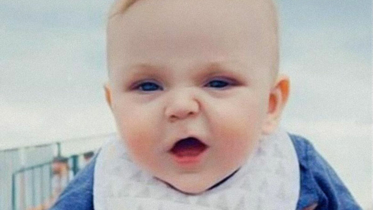 Close-up of a 6-month-old baby wearing a white bib and blue outfit, with a concerned expression outdoors.