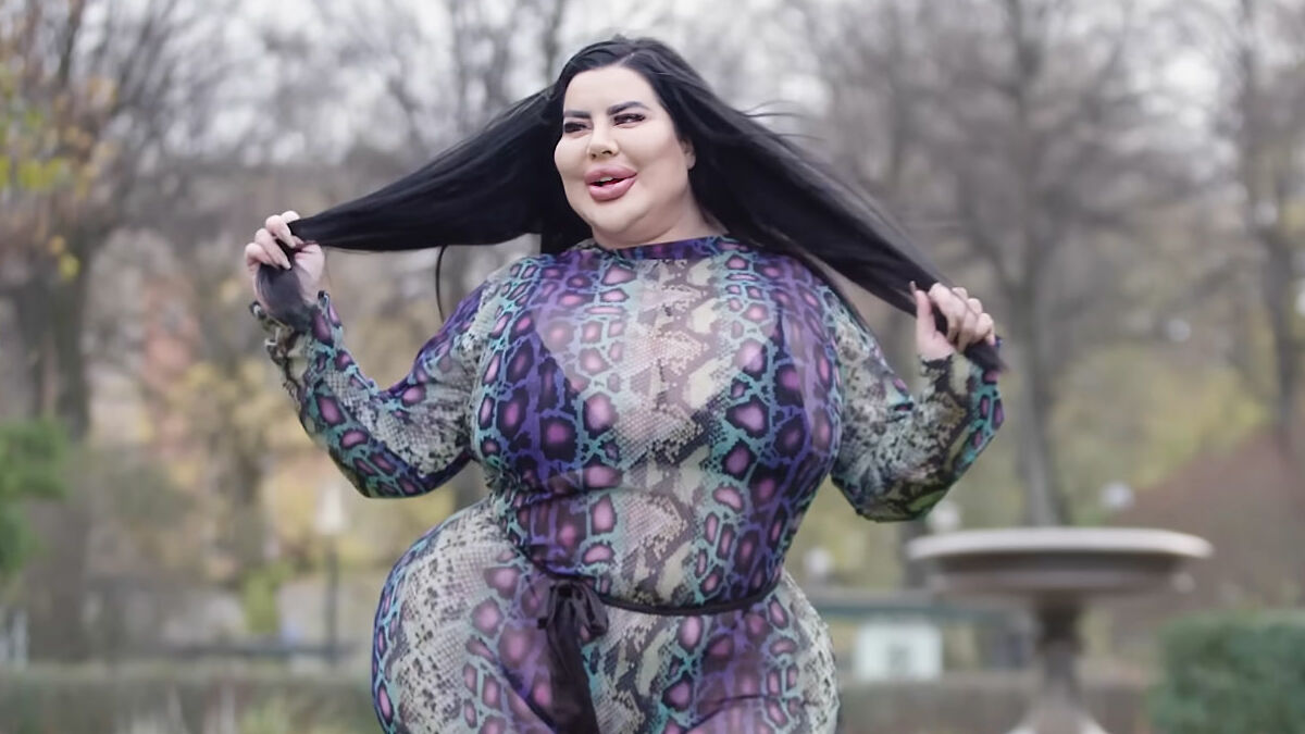 Plastic surgery enthusiast posing outdoors in colorful outfit after multiple BBL procedures, showcasing body transformation.