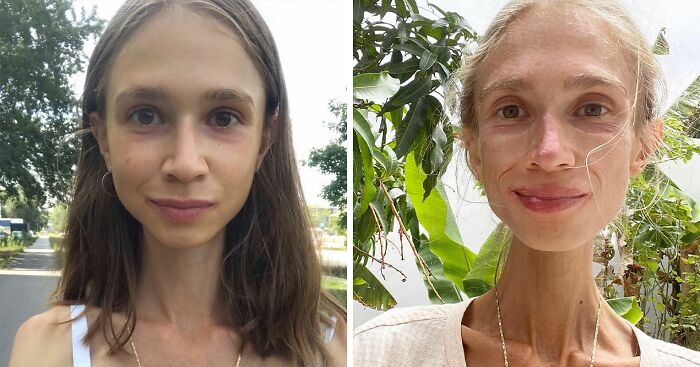 Vegan Woman, 27, Found Lifeless In Hotel Room After Adopting New Raw Diet