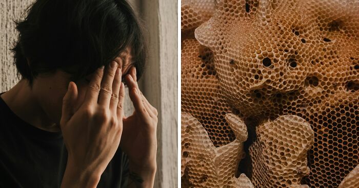 Trypophobia Explained: Why Your Brain Reacts To Tiny Holes