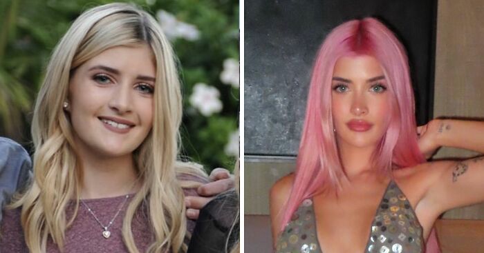 Charlie Sheen’s Daughter Posts Shocking Before-And-After Photos Revealing All Her Plastic Surgeries