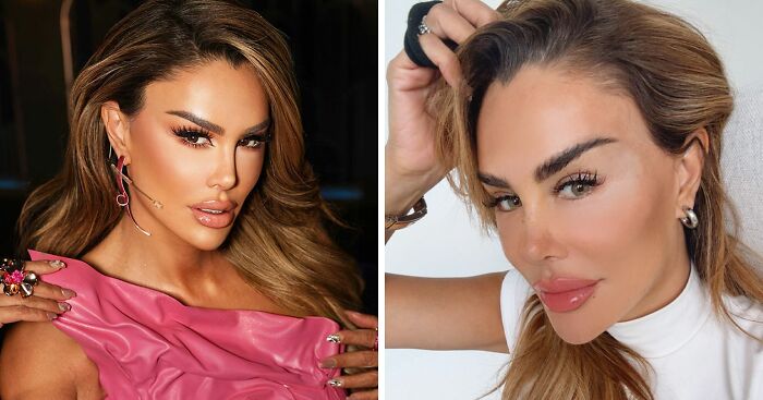 “Risking Blindness”: Actress Reveals She Had Controversial Surgery To Change Her Eye Color