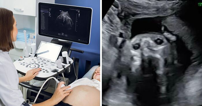 Pregnant Woman’s Sonogram Image Goes Viral After She Spots Hilarious Detail