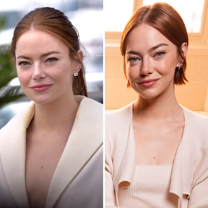 Emma Stone in two photos wearing light-colored outfits, sparking plastic surgery speculation amid Louis Vuitton events. Emma Stone in two photos wearing light-colored outfits, sparking plastic surgery speculation amid Louis Vuitton events.