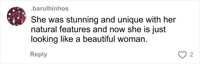 Comment discussing Jennifer Lawrence's natural look and reactions to plastic surgery plans after viral video shock. Comment discussing Jennifer Lawrence's natural look and reactions to plastic surgery plans after viral video shock.