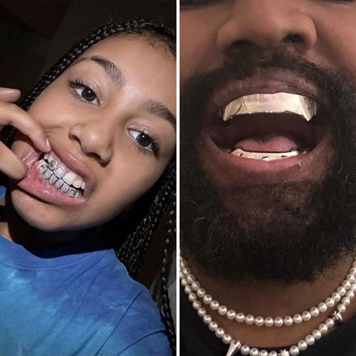 North West showing grills on her teeth next to Kanye West with gold grills, highlighting online life and new look. North West showing grills on her teeth next to Kanye West with gold grills, highlighting online life and new look.
