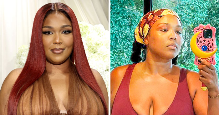 Lizzo’s Wellness Evolution As Seen In “Before And After” Photos