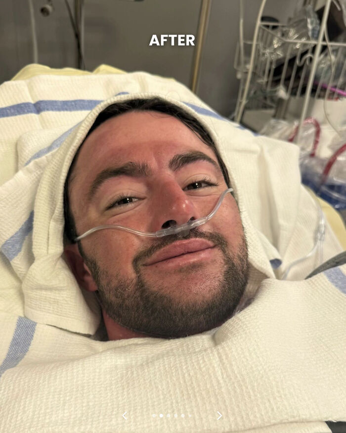 Man Who Swam For 110 Miles Without Sleeping Reveals "Intense" Hallucinatory Experience Man Who Swam For 110 Miles Without Sleeping Reveals "Intense" Hallucinatory Experience