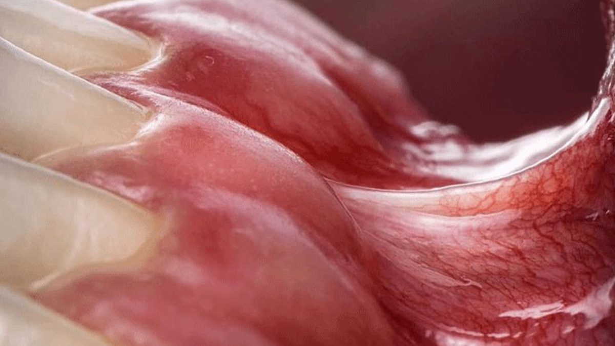 Close-up of red, translucent medical tissue showing detailed veins and structures in a fascinating medical post image.