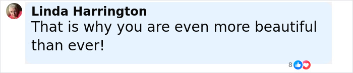 "Weird Thing Being A Woman": Keri Russell, 49, Slams Hollywood's Growing Plastic Surgery Trend