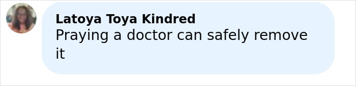 Man with large 4-lb face tumor seeking urgent medical help after doctor issues fatal warning in online post. Man with large 4-lb face tumor seeking urgent medical help after doctor issues fatal warning in online post.