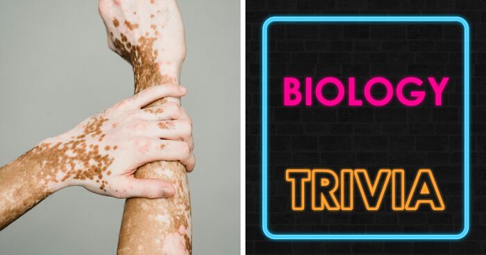 “Are You Smarter Than The Average U.S. Student?”: Test Yourself With 30 Questions Straight From Biology Class