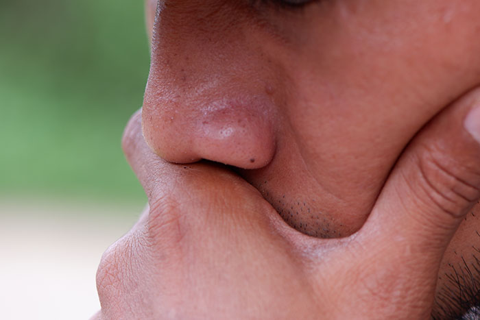 47 Patients Who Thought It Was Minor But Ended Up In The Operating Room