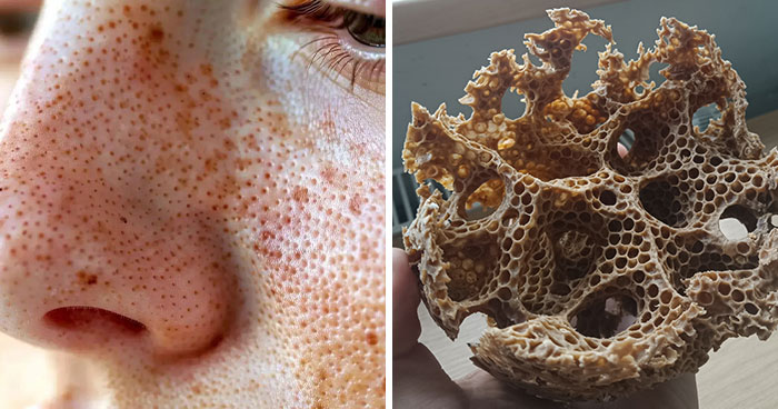 Trypophobia Warning: 50 Unsettling Pics You Won’t Be Able To Unsee (New Pics)