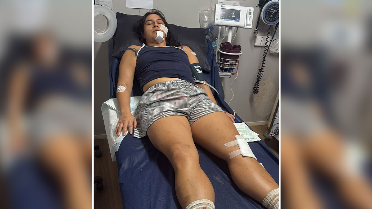 Woman lying unconscious on hospital bed with medical bandages and monitoring equipment around her after bird incident