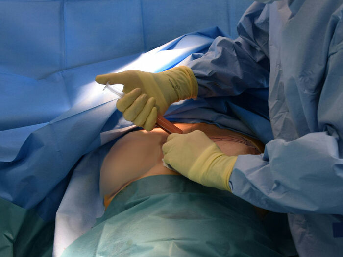 Fake plastic surgeon performing botched silicone injections on patient during a cosmetic procedure in a surgical setting. Fake plastic surgeon performing botched silicone injections on patient during a cosmetic procedure in a surgical setting.