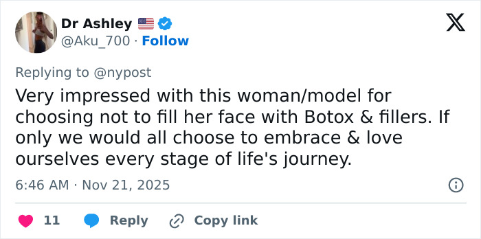 Twitter post praising Paulina Porizkova, 60, for embracing perfect imperfections and natural beauty without fillers.