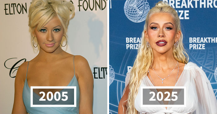 25 Then And Now Shots Of Stars In 2005, 2015 And 2025, Including One Who Was Left “Disfigured”