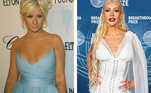 25 Then And Now Shots Of Stars In 2005, 2015 And 2025, Including One Who Was Left “Disfigured”