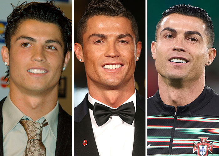 Cristiano Ronaldo before and after shots in 2005, 2015, and 2025 showing dramatic changes in appearance.