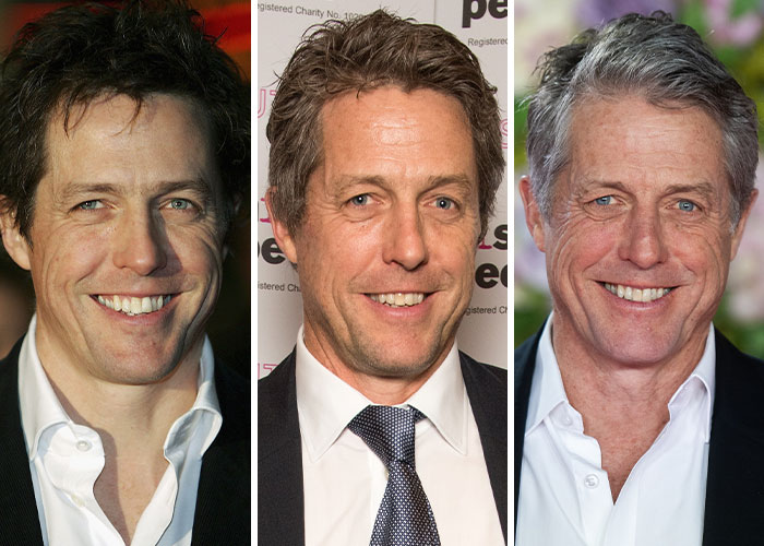 Hugh Grant before and after shots in 2005, 2015, and 2025 showing dramatic celebrity changes over time.