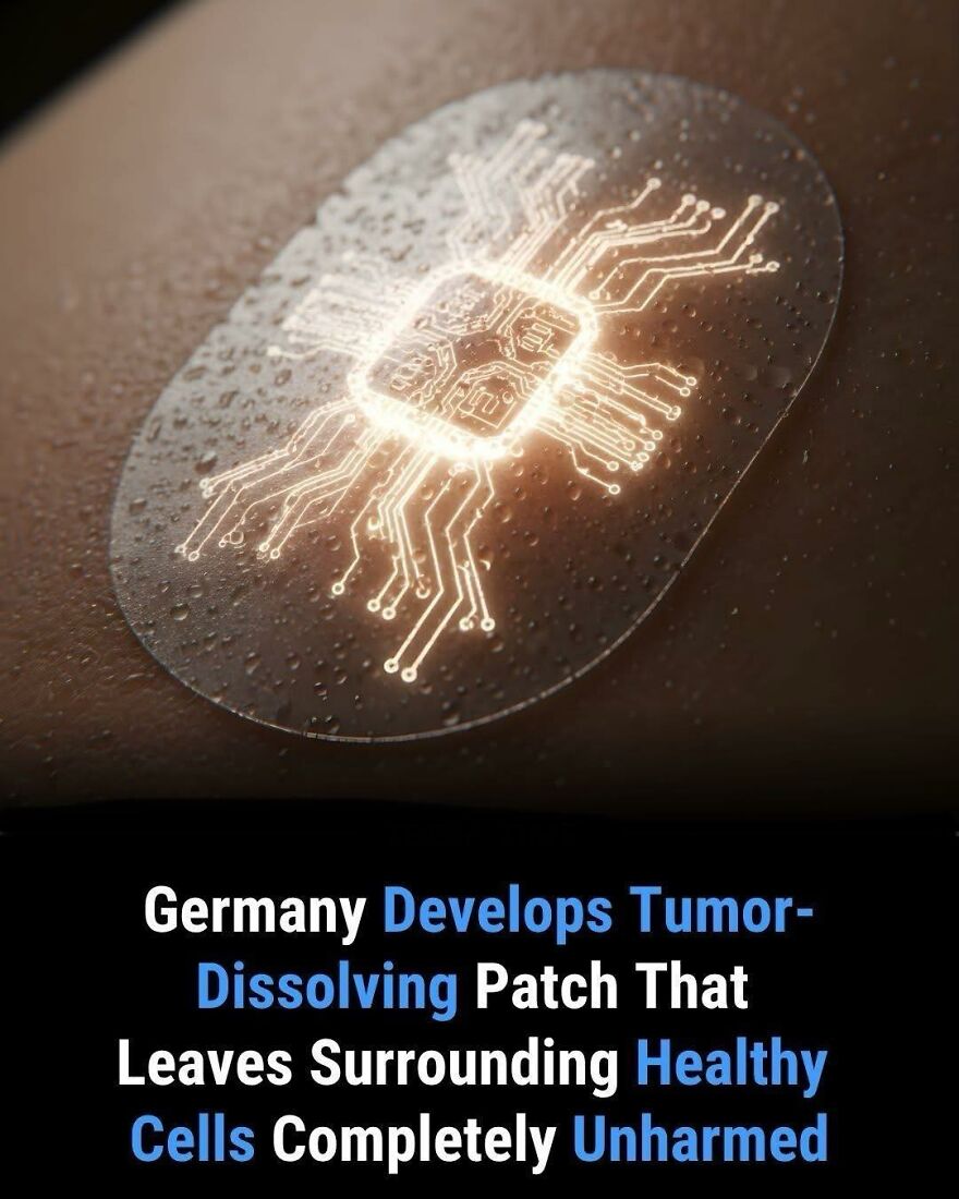 High-tech tumor-dissolving patch developed in Germany protecting healthy cells in medical innovation fact.