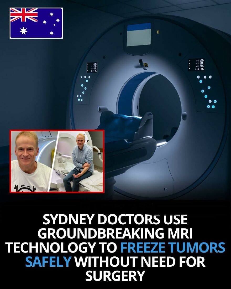MRI technology used by Sydney doctors to safely freeze tumors, showcasing innovative medical facts and breakthroughs.